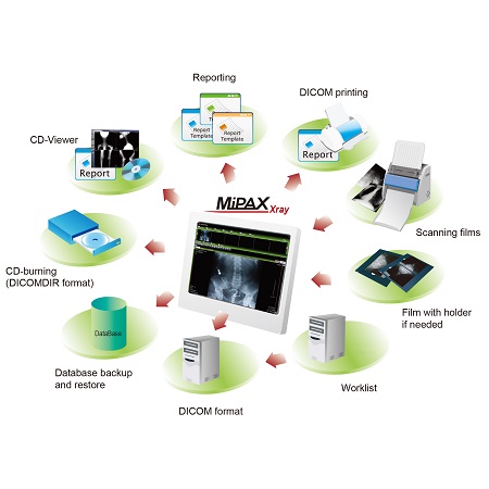 Sistema De Gerenciamento De Imagem Médica - 8-8,Medical Film Archiving Solution (MiPAX-Xray) Sistema De Gerenciamento De Imagem Médica - 8-8,Medical Film Archiving Solution (MiPAX-Xray)